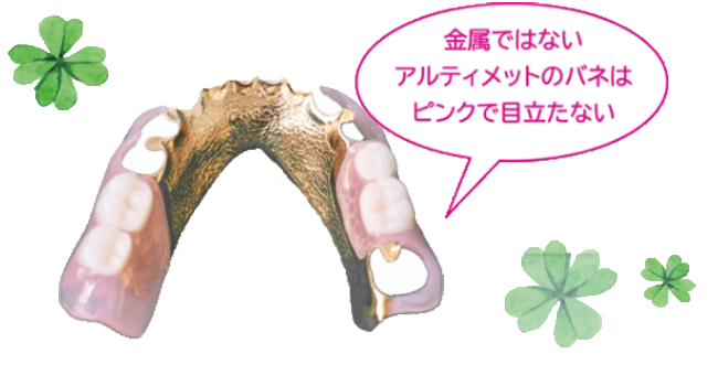アルティメット樹脂の特徴