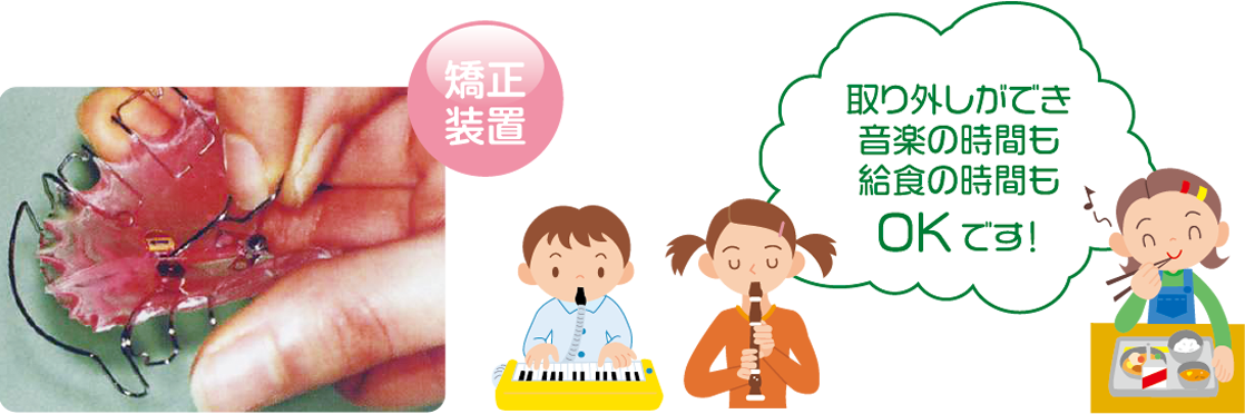 装置の使用例