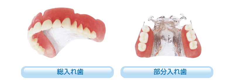 チタン床（純チタン・チタン合金）による入れ歯