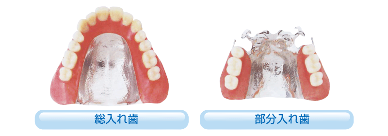 コバルト床S　(スタンダードタイプ)による入れ歯