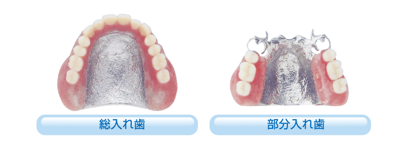 コバルト床E　(エコノミータイプ)による入れ歯