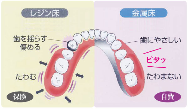 たわまないので歯に優しく、良くかめる